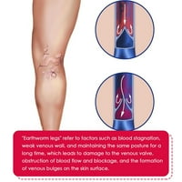 Rose Care uljna noga za umorne noge može promovirati glatku kožu i cirkulaciju u krvi čine da noge izgledaju